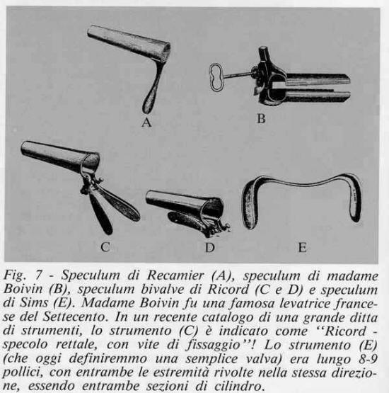 storia dello speculum vaginale,history of Vaginal Specula, histoire du